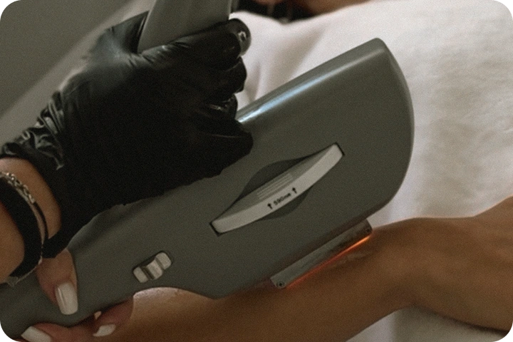 הסרת שיער פרימיום IPL